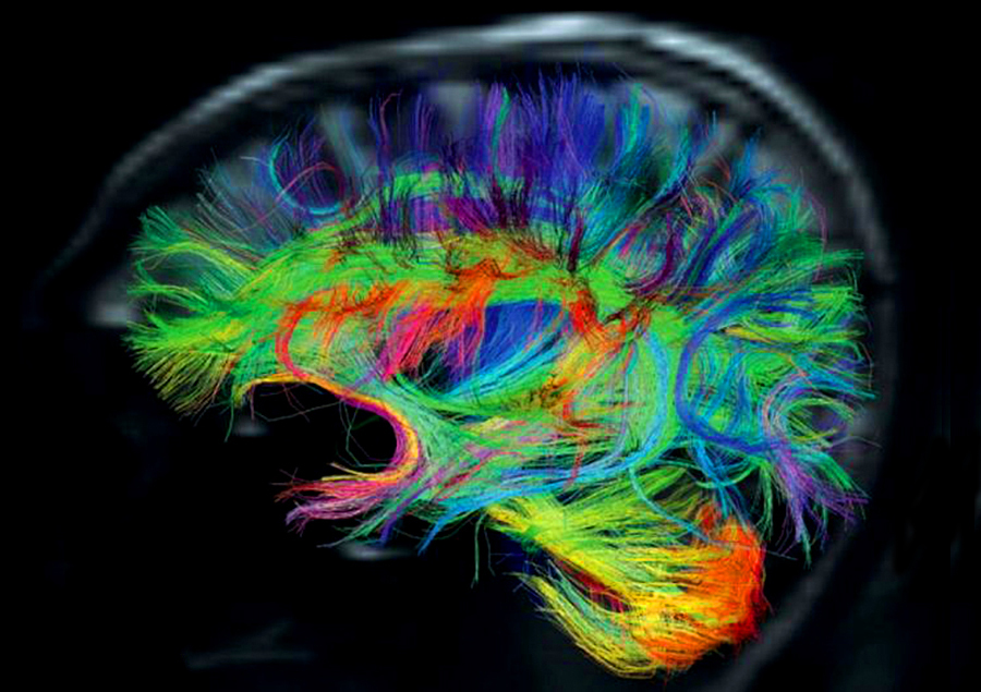 Brain fiber
